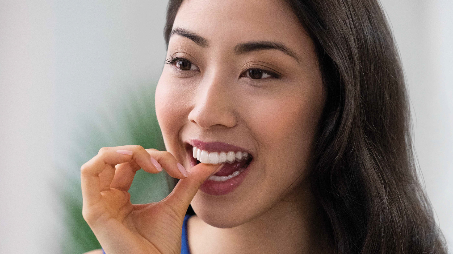 TEETH Invisalign Singapore straighten teeth