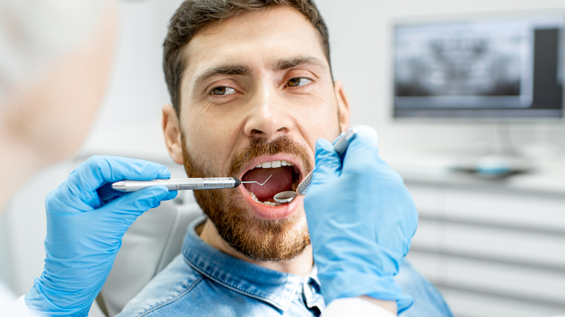 dental crown costs singapore dental bridges singapore