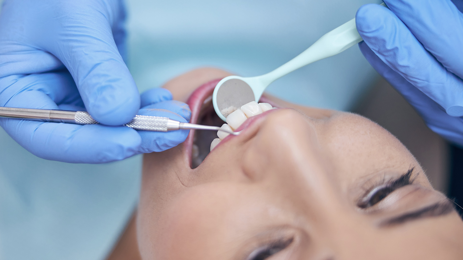 dental crown bridge implant supported crown