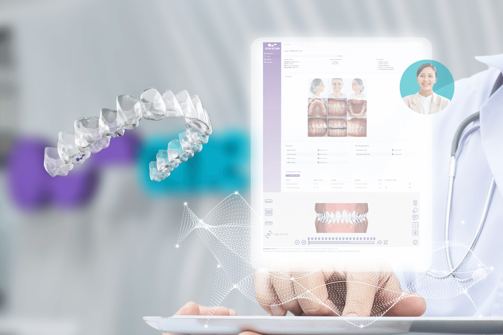 OneSmile clear braces Singapore