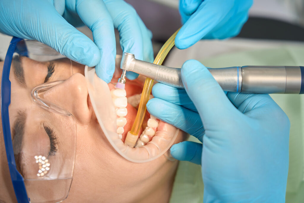 dental cleaning and polishing