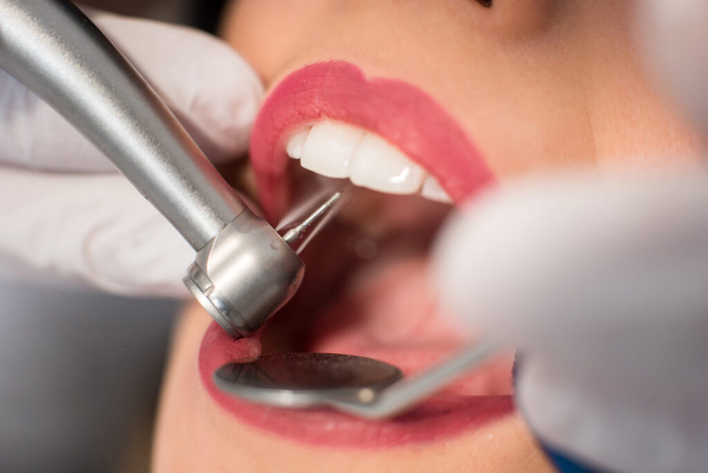 what causes teeth grinding
