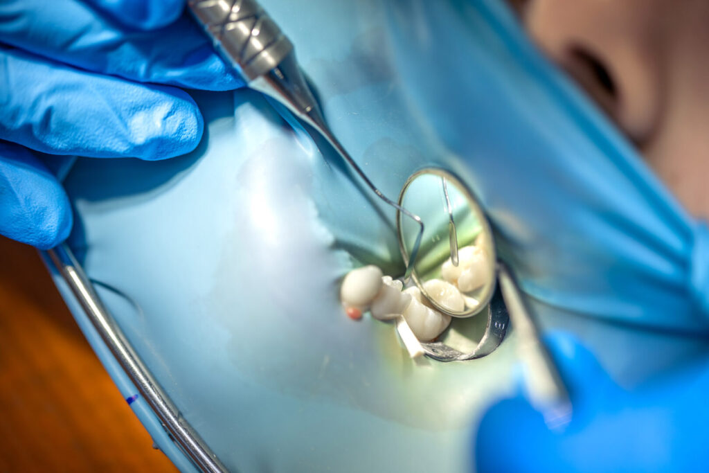 molar tooth extraction aftercare