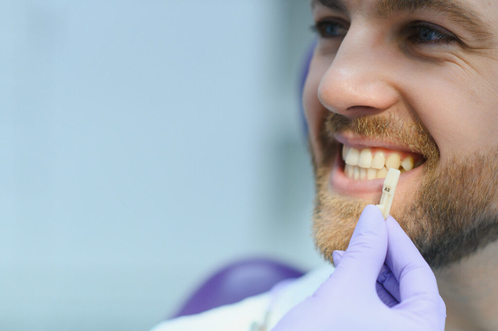composite veneers pros and cons