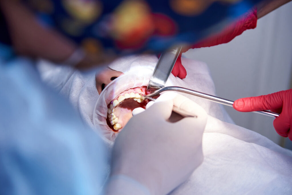 cost for wisdom tooth extraction