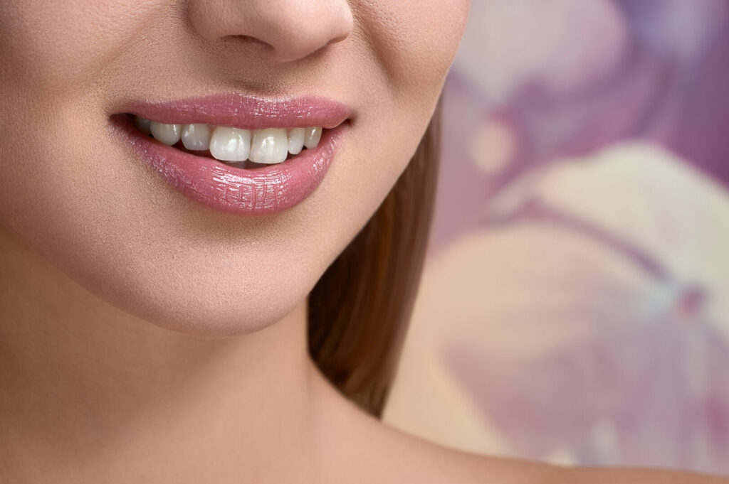 porcelain veneers in Singapore
