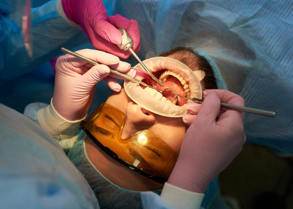 removal of wisdom tooth cost