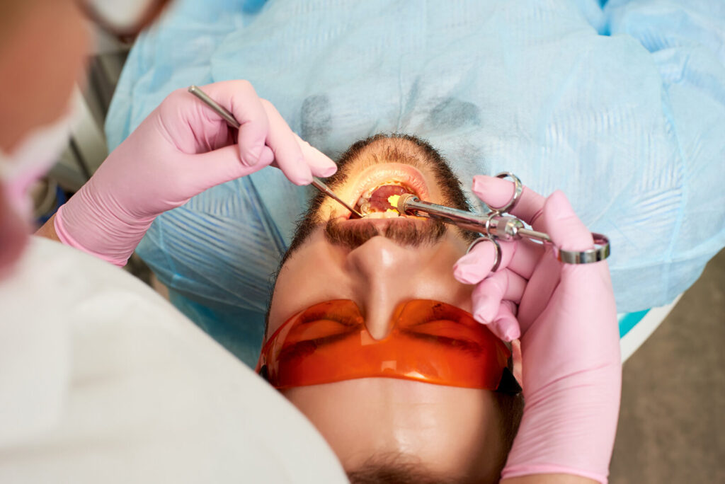 wisdom tooth removal