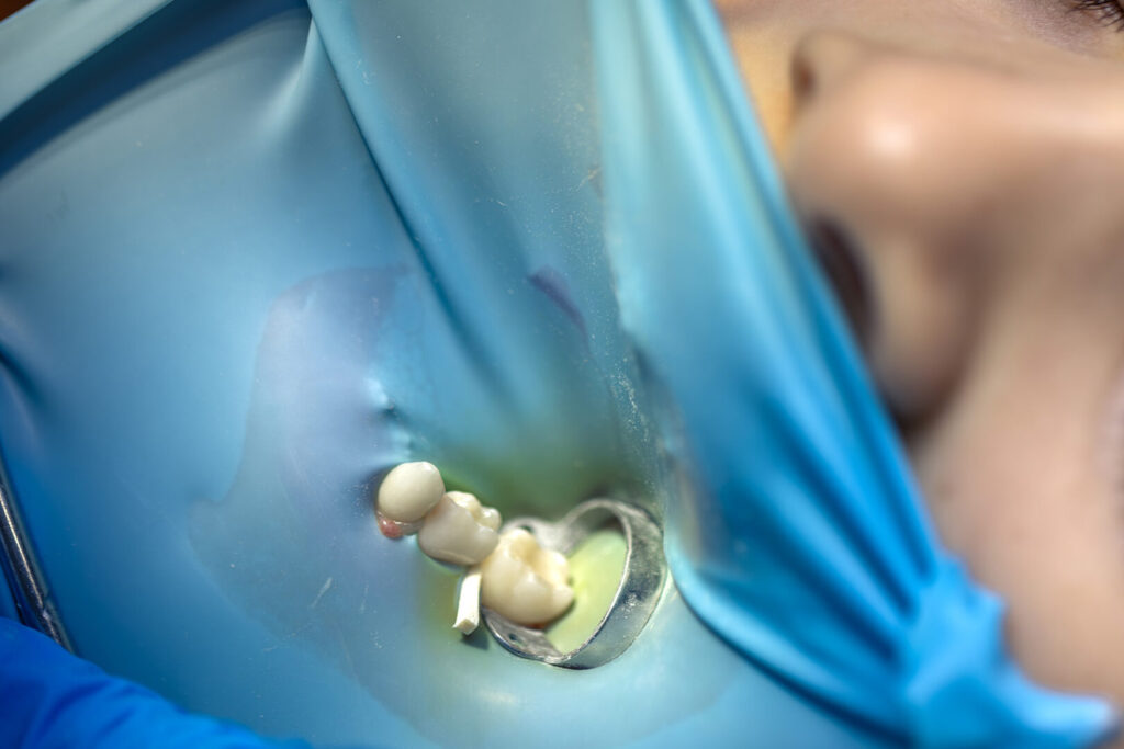 affordable dental implants Singapore