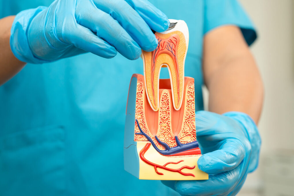 root canal treatment Singapore