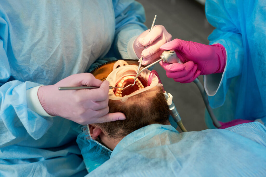 root canal treatment cost