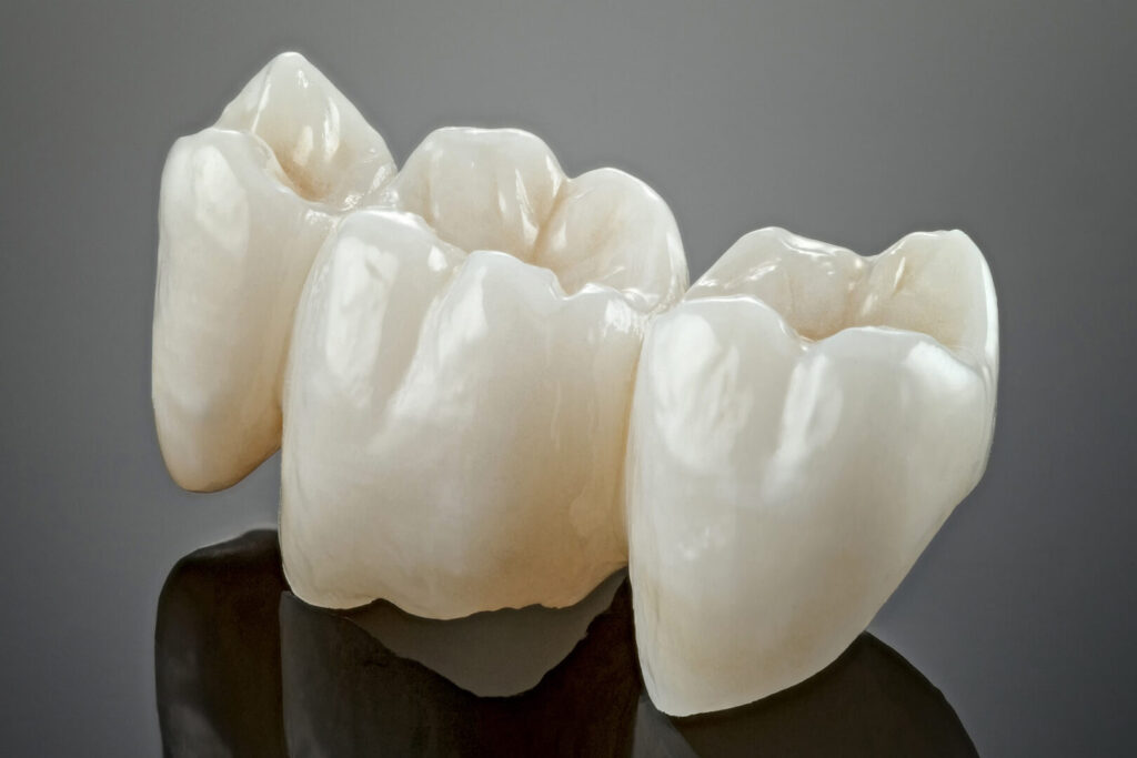 tooth crown materials
