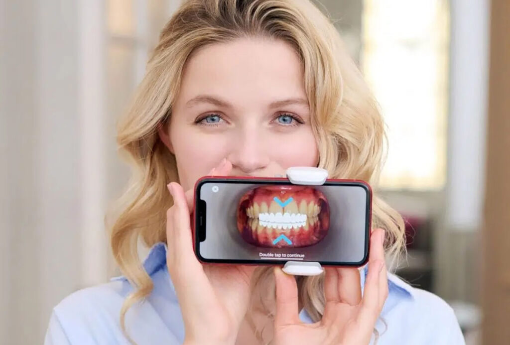 OneSmile clear aligners