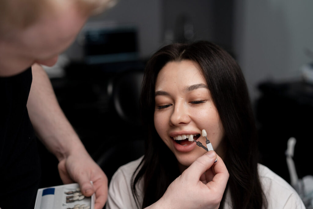 benefits of dental veneers