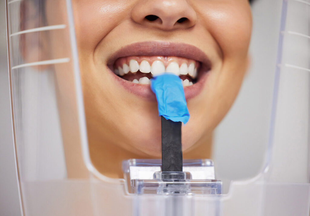 how much do dental veneers cost