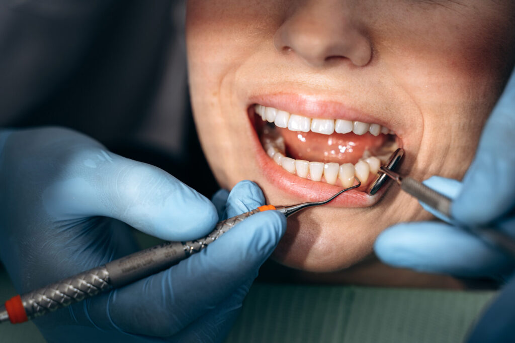 non-surgical periodontal treatment cost