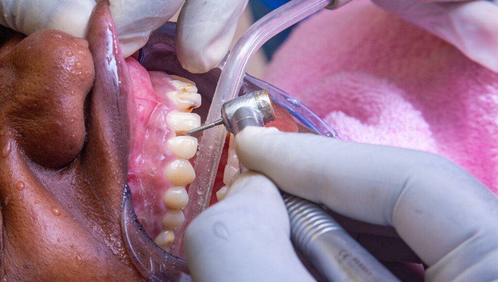 periodontal treatment cost