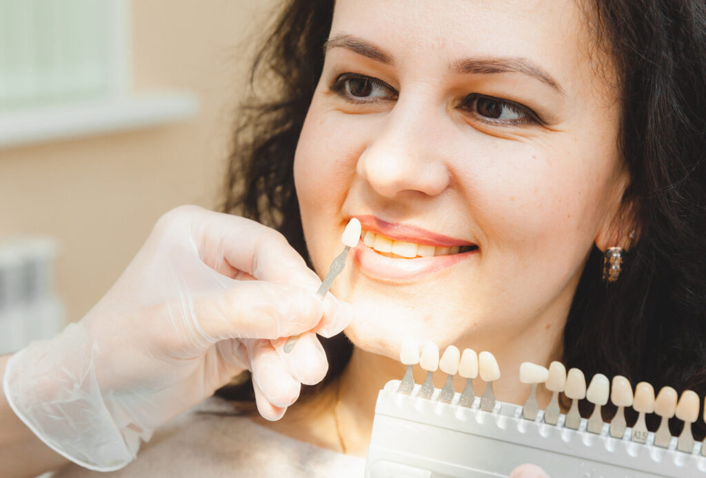 what are dental veneers